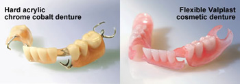 Valplast Dentures