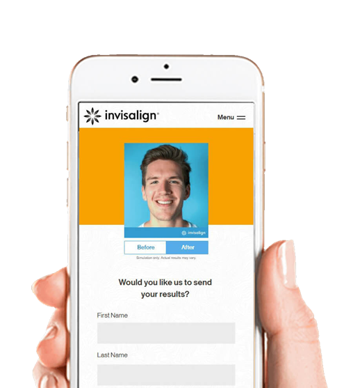 Invisalign Smile